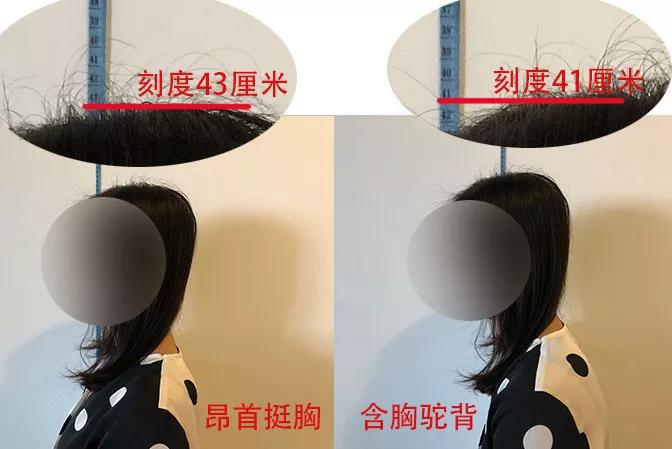 你可能也變得脖子前傾、含胸駝背了